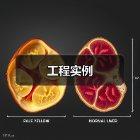工程实例(图4) 工程实例(图4)